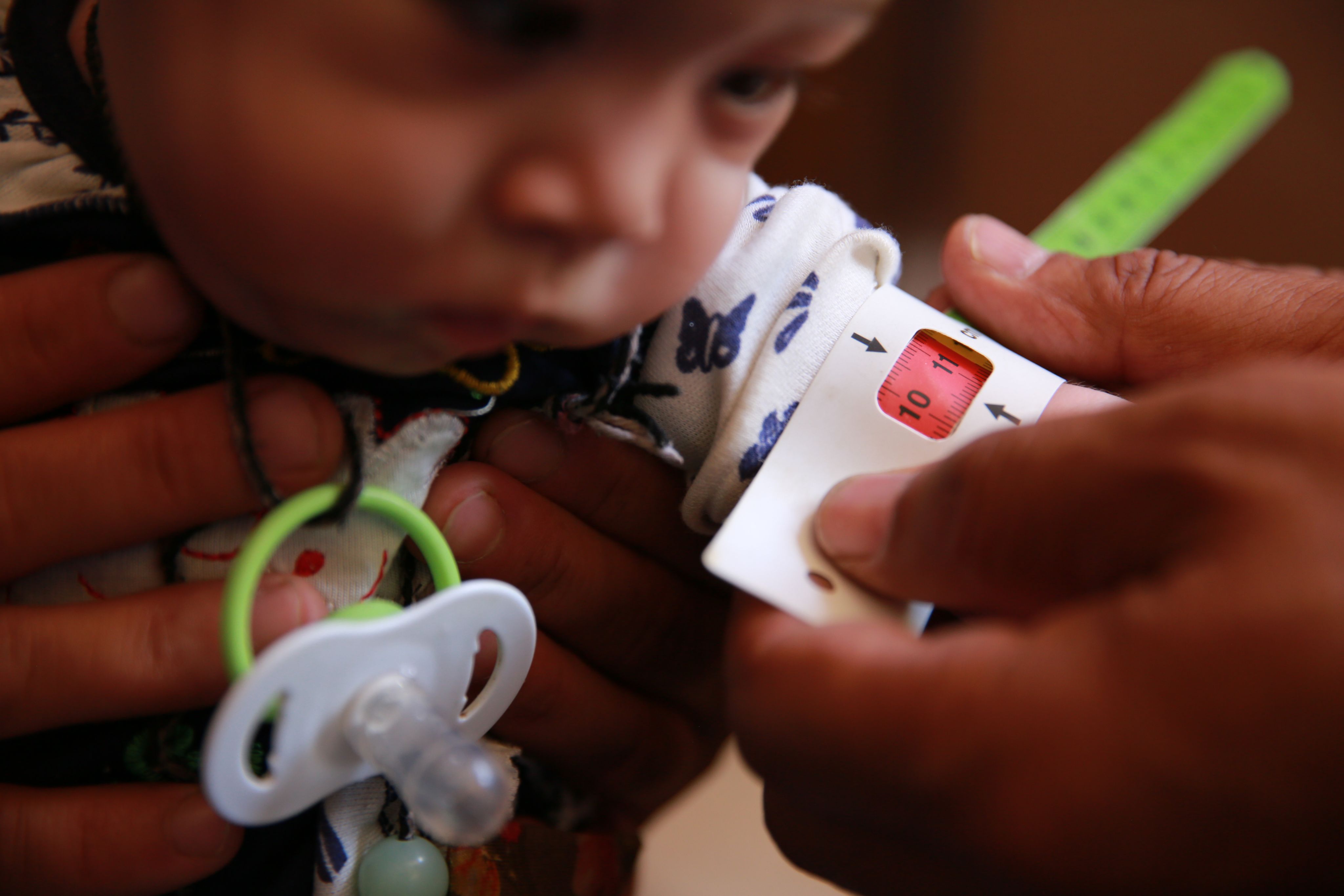 Nadira* (8 months) is screened for Malnutrition by Save the Children's Mobile Health Doctor